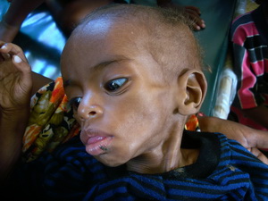 LHQ kêu gọi cứu khẩn cấp gần 40.000 trẻ Somalia 
